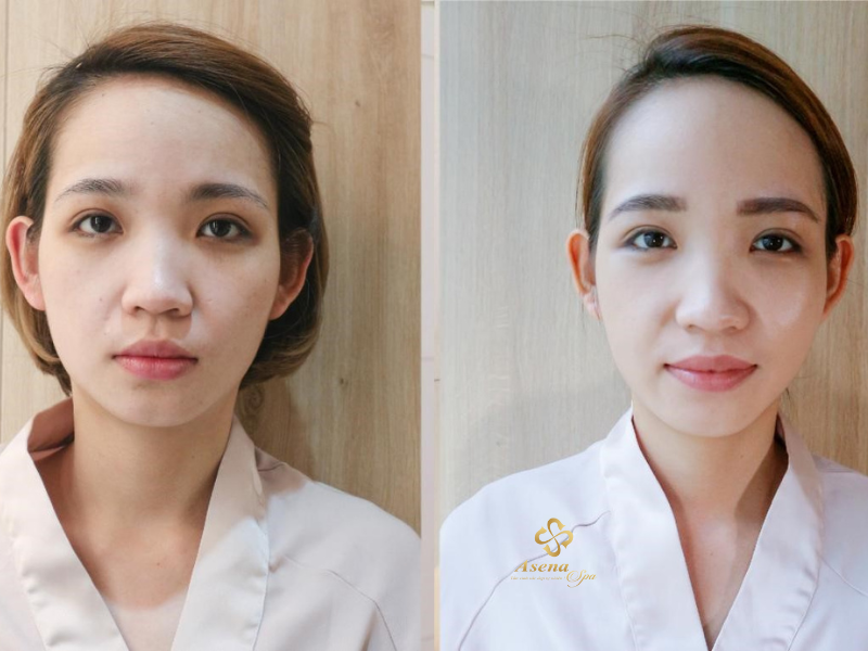 spa cân chỉnh khuôn mặt  tại Quảng Bình